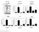 Fig. 02 - Antifibrotic effects of oxetanyl sulfoxides