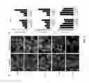 Fig. 06 - Small molecule transcription modulators of bromodomains
