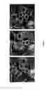 Fig. 18 - Small molecule transcription modulators of bromodomains