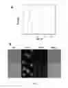 Fig. 08 - Chemically activated nanocapsid functionalized for cancer targeting