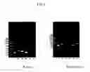 Fig. 02 - Methods of cancer therapy by inhibiting fusion polypeptides comprising fibroblast growth factor receptor 2 (FGFR2) and vinculin (VCL)
