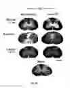 Fig. 04 - METHODS OF MODULATING INFLAMMASOME ACTIVITY TO TREAT INFLAMMATORY CONDITIONS