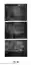 Fig. 05 - METHODS OF MODULATING INFLAMMASOME ACTIVITY TO TREAT INFLAMMATORY CONDITIONS