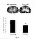 Fig. 06 - METHODS OF MODULATING INFLAMMASOME ACTIVITY TO TREAT INFLAMMATORY CONDITIONS