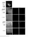 Fig. 04 - Provasopressin antagonists and uses thereof