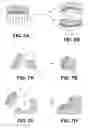 Fig. 07 - Orthopedic implants having gradient polymer alloys