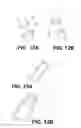 Fig. 11 - Orthopedic implants having gradient polymer alloys