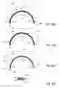 Fig. 44 - Orthopedic implants having gradient polymer alloys