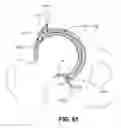 Fig. 47 - Orthopedic implants having gradient polymer alloys