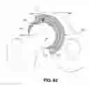 Fig. 48 - Orthopedic implants having gradient polymer alloys