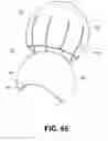 Fig. 50 - Orthopedic implants having gradient polymer alloys