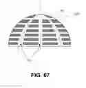 Fig. 52 - Orthopedic implants having gradient polymer alloys