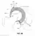 Fig. 53 - Orthopedic implants having gradient polymer alloys