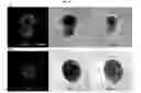 Fig. 22 - Method for preparing induced pluripotency stem cells from mesenchymal stem cells by using phlorotannin fraction