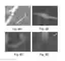 Fig. 14 - METHODS FOR DIFFERENTIATION