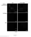 Fig. 16 - Therapeutic use of CD31 expressing cells