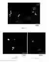 Fig. 18 - Therapeutic use of CD31 expressing cells