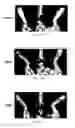 Fig. 20 - Therapeutic use of CD31 expressing cells