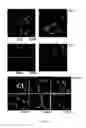 Fig. 22 - Therapeutic use of CD31 expressing cells