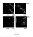 Fig. 23 - Therapeutic use of CD31 expressing cells