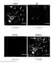 Fig. 38 - Therapeutic use of CD31 expressing cells