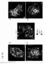 Fig. 03 - Method for producing sinoatrial node cells (pacemaker cells) from stem cells, and use of the produced sinoatrial node cells