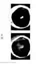 Fig. 19 - Method for producing sinoatrial node cells (pacemaker cells) from stem cells, and use of the produced sinoatrial node cells