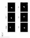 Fig. 24 - Method for producing sinoatrial node cells (pacemaker cells) from stem cells, and use of the produced sinoatrial node cells