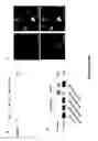 Fig. 06 - Compositions and Methods for Treating and Preventing Pancreatitis, Renal Injury and Cancer