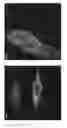 Fig. 13 - Double-stranded RNA conjugates and their use