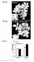 Fig. 04 - ISOLATED NUCLEIC ACIDS AND QUANTITATIVE TRAIT LOCI (QTL) FROM S. HABROCHAITES AND METHODS OF USE THEREOF FOR INCREASING RESISTANCE TO BACTERIAL SPECK DISEASE IN TOMATO AND OTHER PLANTS
