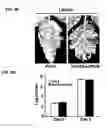 Fig. 06 - ISOLATED NUCLEIC ACIDS AND QUANTITATIVE TRAIT LOCI (QTL) FROM S. HABROCHAITES AND METHODS OF USE THEREOF FOR INCREASING RESISTANCE TO BACTERIAL SPECK DISEASE IN TOMATO AND OTHER PLANTS