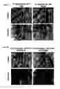 Fig. 09 - ISOLATED NUCLEIC ACIDS AND QUANTITATIVE TRAIT LOCI (QTL) FROM S. HABROCHAITES AND METHODS OF USE THEREOF FOR INCREASING RESISTANCE TO BACTERIAL SPECK DISEASE IN TOMATO AND OTHER PLANTS
