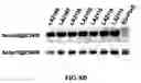 Fig. 13 - ISOLATED NUCLEIC ACIDS AND QUANTITATIVE TRAIT LOCI (QTL) FROM S. HABROCHAITES AND METHODS OF USE THEREOF FOR INCREASING RESISTANCE TO BACTERIAL SPECK DISEASE IN TOMATO AND OTHER PLANTS