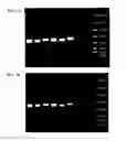 Fig. 10 - METHOD FOR OBTAINING IMMUNOGLOBULIN ENCODING NUCLEIC ACID