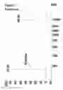 Fig. 09 - Method for attaching one or more polynucleotide binding proteins to a target polynucleotide