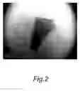 Fig. 03 - Method of preparing of natural graphene cellulose blended meltblown nonwoven fabric