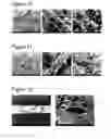 Fig. 05 - Complexes of calcium carbonate microparticles and fibers as well as processes for preparing them