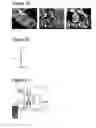 Fig. 08 - Complexes of calcium carbonate microparticles and fibers as well as processes for preparing them