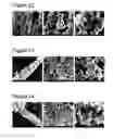 Fig. 09 - Complexes of calcium carbonate microparticles and fibers as well as processes for preparing them