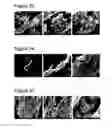 Fig. 10 - Complexes of calcium carbonate microparticles and fibers as well as processes for preparing them