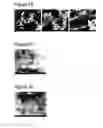 Fig. 11 - Complexes of calcium carbonate microparticles and fibers as well as processes for preparing them