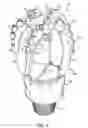 Fig. 02 - Alternative materials for mandrel in infiltrated metal-matrix composite drill bits
