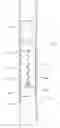 Fig. 01 - Downhole plunger with spring-biased pads