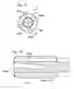 Fig. 11 - Systems and apparatuses for separating wellbore fluids and solids during production