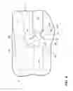 Fig. 05 - Shroud assembly for a gas turbine engine