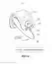 Fig. 07 - Exhaust valve for muffler and muffler including the same