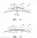 Fig. 04 - Wind turbine rotor blade assembly with surface features