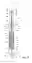 Fig. 06 - Tandem motor linear rod pump