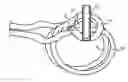 Fig. 01 - Attachment device